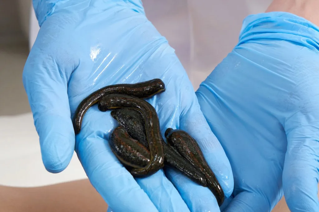 Doctor holding a pile of leeches