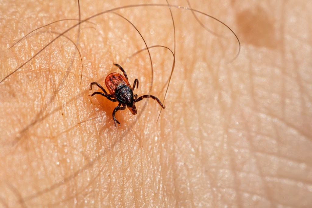 Red and black tick crawling across someone's skin.